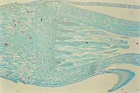 Attēlu rezultāti vaicājumam “Mnium hornum sporophyte”