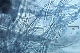 Attēlu rezultāti vaicājumam “Cinereomyces lindbladii”