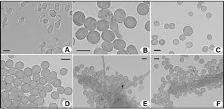 Attēlu rezultāti vaicājumam “Lamproderma puncticulatum spores”