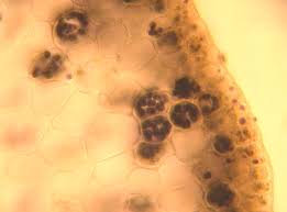 Attēlu rezultāti vaicājumam “Conocephalum salebrosum sporophyte”