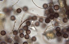 Attēlu rezultāti vaicājumam “Didymium xanthopus spores”