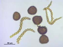 Attēlu rezultāti vaicājumam “Fossombronia wondraczekii”