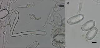 Attēlu rezultāti vaicājumam “Erysiphe galeopsidis”