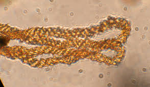 Attēlu rezultāti vaicājumam “Metatrichia vesparia spores”