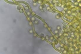 Attēlu rezultāti vaicājumam “Hemitrichia sordivesiculosa”