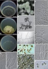 Attēlu rezultāti vaicājumam “Heterotrichia oerstedii (syn. Arcyria oerstedii) macro”