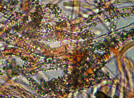 Attēlu rezultāti vaicājumam “Athelia arachnoidea”