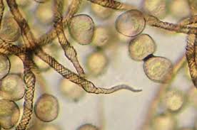 Attēlu rezultāti vaicājumam “Trichia contorta spores”
