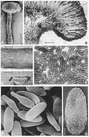 Attēlu rezultāti vaicājumam “Microcalicium disseminatum”