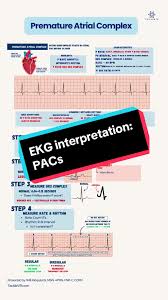 Image result for   㖃      R X v  