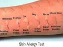 Let Me Go On and On...: False Allergic Reactions: Getting My Life Back