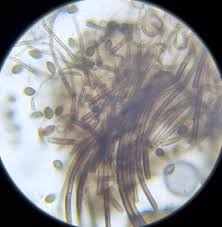 Attēlu rezultāti vaicājumam “Licea minima spores”