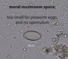 Attēlu rezultāti vaicājumam “Enteridium variabile spores”