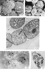 Attēlu rezultāti vaicājumam “Nostoc pruniforme cells”
