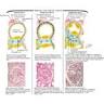 Pathology of the Nephrotic Syndrome - Netter Medical Artwork