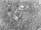 <b>Rift Valley Fever</b>