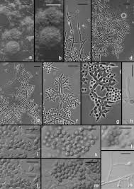 Attēlu rezultāti vaicājumam “Hypocrea rufa”