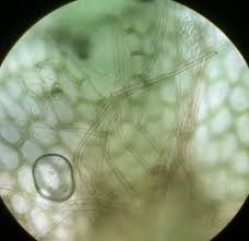 Attēlu rezultāti vaicājumam “Calypogeia neesiana”