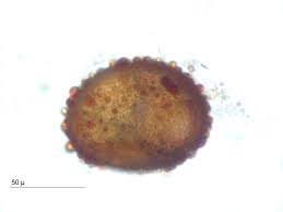 Attēlu rezultāti vaicājumam “Ephemerum serratum”