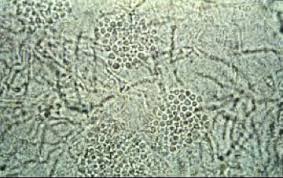 Attēlu rezultāti vaicājumam “Badhamia versicolor spores”