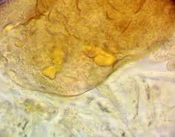 Attēlu rezultāti vaicājumam “Lycogala ustulatum sessile”