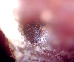 Attēlu rezultāti vaicājumam “Licea minima sessile”