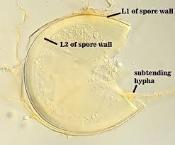 Attēlu rezultāti vaicājumam “Dianema depressum spores”