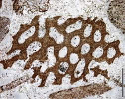 Attēlu rezultāti vaicājumam “Melanospora lagenaria”