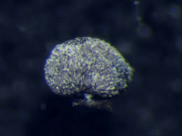 Attēlu rezultāti vaicājumam “Physarum album spores”