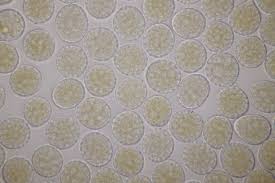 Attēlu rezultāti vaicājumam “Symphytocarpus impexus spores”