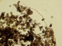 Attēlu rezultāti vaicājumam “Diderma ochraceum macro”