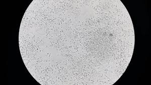 Attēlu rezultāti vaicājumam “Reticularia jurana young”