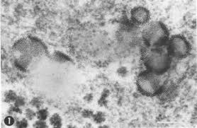 Attēlu rezultāti vaicājumam “Lycogala succineum”