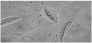 Attēlu rezultāti vaicājumam “Dianema nivale spores”