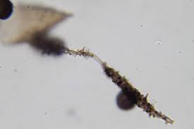 Attēlu rezultāti vaicājumam “Diderma subviridifuscum spores”