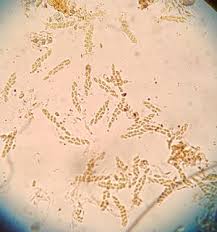Attēlu rezultāti vaicājumam “Licea castanea spores”