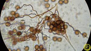 Attēlu rezultāti vaicājumam “Diderma crustaceum spores”