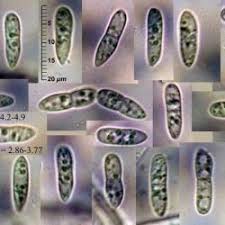 Attēlu rezultāti vaicājumam “Hymenoscyphus fructigenus var. coryli”