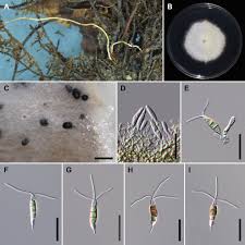 Attēlu rezultāti vaicājumam “Stemonitopsis aequalis var. microspora stalked”