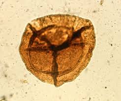 Attēlu rezultāti vaicājumam “Diachea muscorum spores”