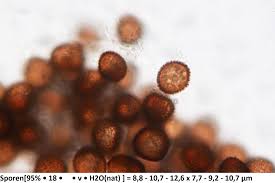Attēlu rezultāti vaicājumam “Badhamia capsulifera macro”