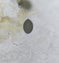 Attēlu rezultāti vaicājumam “Sordaria fimicola”