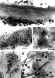 Attēlu rezultāti vaicājumam “Amaurochaete fusiformis spores”