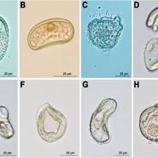 Attēlu rezultāti vaicājumam “Oligonema affine spores”