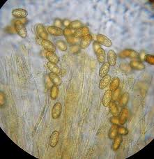Attēlu rezultāti vaicājumam “Sowerbyella radiculata”