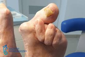 Znalezione obrazy dla zapytania palec