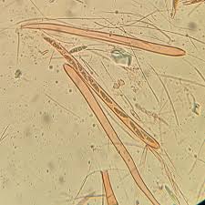 Attēlu rezultāti vaicājumam “Ombrophila violacea spores”