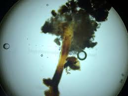 Attēlu rezultāti vaicājumam “Chaenotheca trichialis”