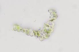 Attēlu rezultāti vaicājumam “Dicranella staphylina cells”