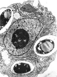 Attēlu rezultāti vaicājumam “Physarum flavicomum stalked”